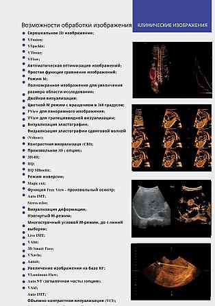 Информация о возможностях обработки изображений на ультразвуковой диагностической системе