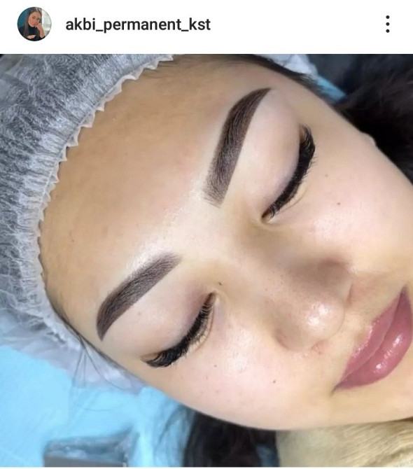 Клиенттің процедурадан кейінгі дұрыс көздің формасы