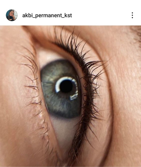 Көздің жақыннан көрінісі, мәнерлі зрачок