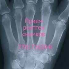 Рентгеновский снимок руки с текстом на русском языке