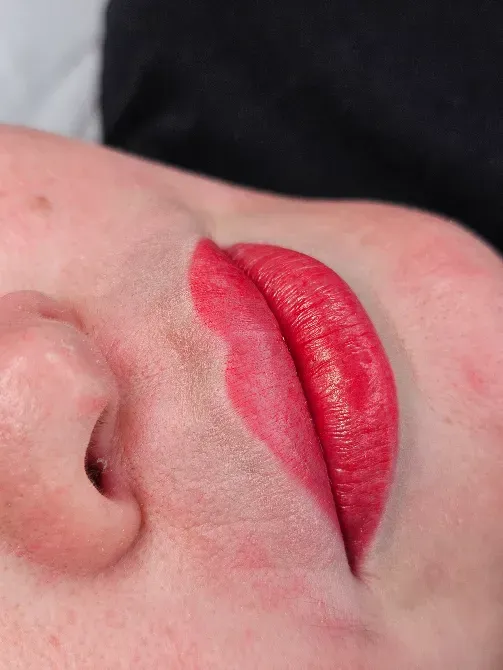 Қызыл ерін далабы бар еріннің суреті