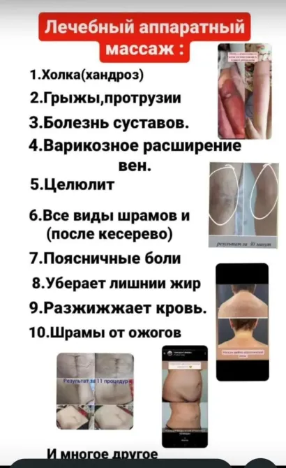 Лечебный аппаратный массаж и его преимущества