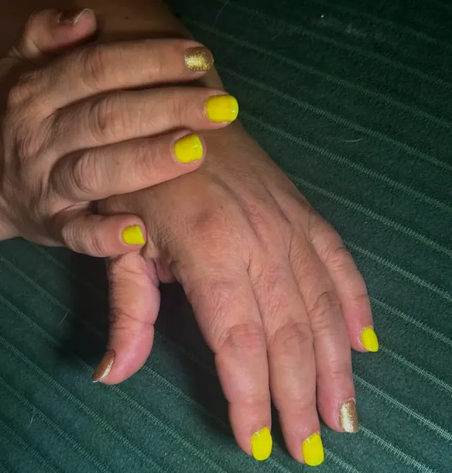 Ярко-жёлтые ногти на руках, один ноготь с золотым оттенком