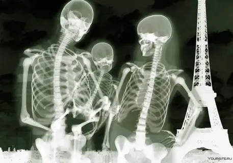 Эйфеле мұнарасы фонында рентген суретінде скелеттер