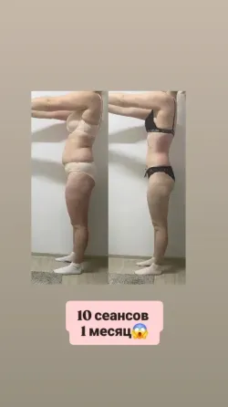 Изображение с результатами изменения тела после 7 сеансов