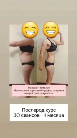 Изображение с результатами изменения тела после 7 сеансов