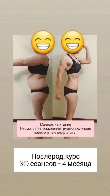 Изображение с результатами после 30 сеансов послеродової программы
