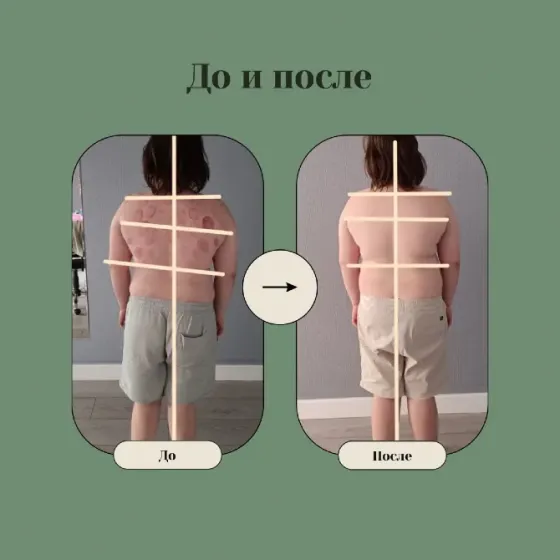 Баладағы қалыпты өзгеріс: до және кейін